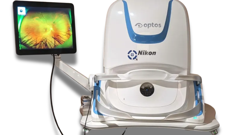 Optos digital retinal imaging device with retinal scan on screen